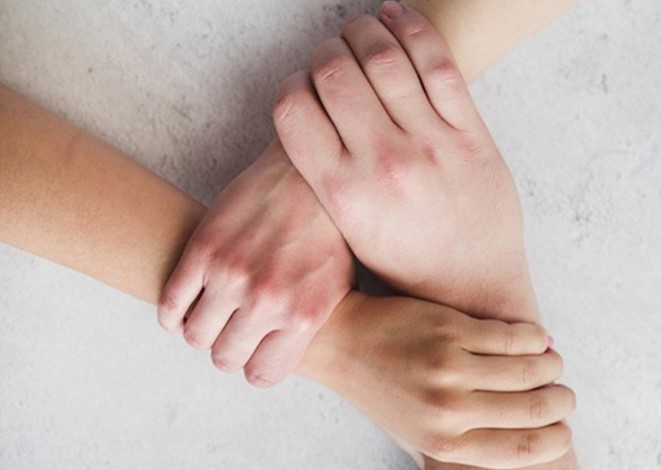 DÃA MUNDIAL DE LA PREVENCIÃ“N DEL SUICIDIO